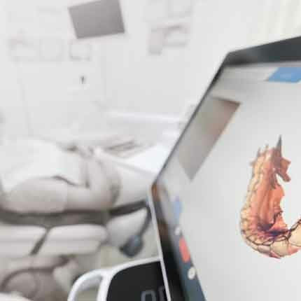 Utilizing a Digital Workflow for Implant Treatment Planning