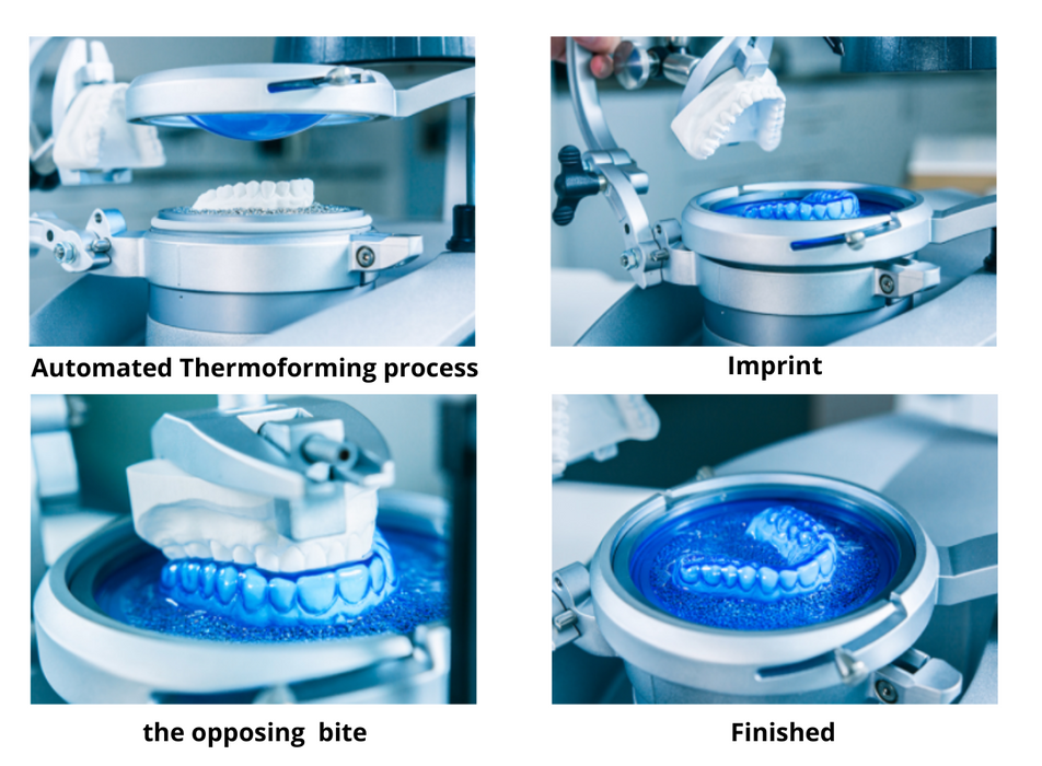 Erkoform 3d Motion process